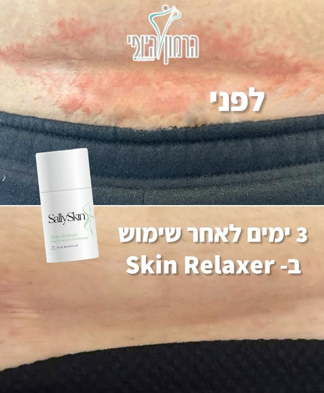 קרם הרגעה ושיקום – Skin Relaxer